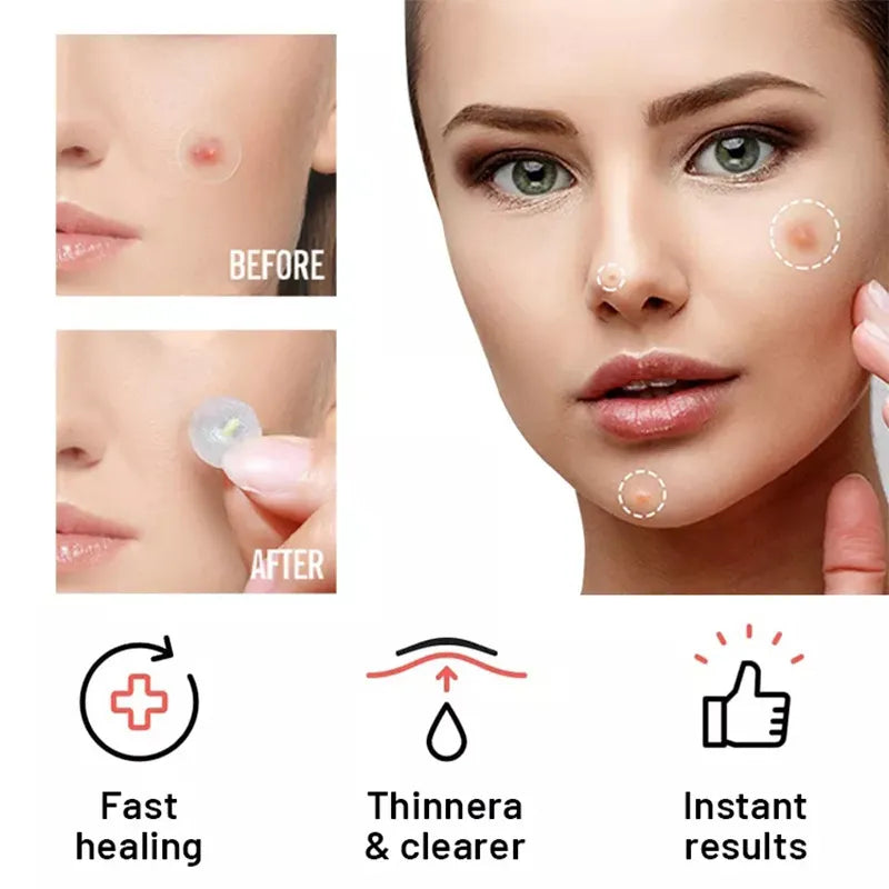 Acne Patch Day Night Repair